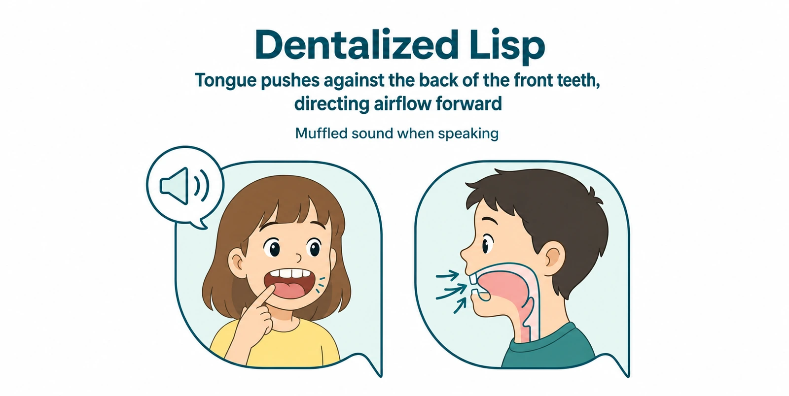 Illustration of a dentalized lisp